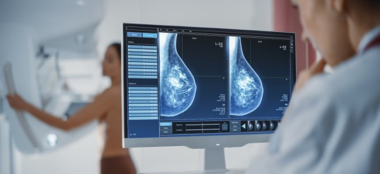 Ärztin schaut sich Brustscans an