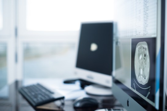 Ansicht von Computern mit Hirn-Scan